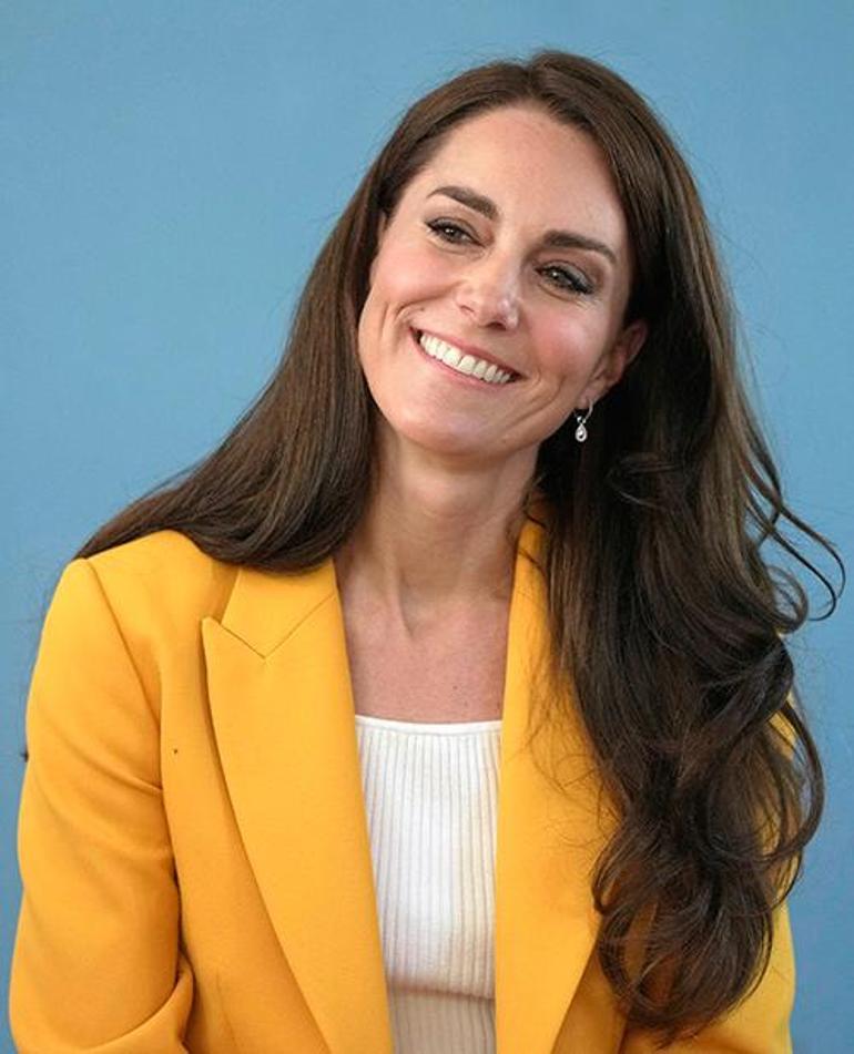 Kate Middleton'ın Saçları ve Kanser Tedavisi