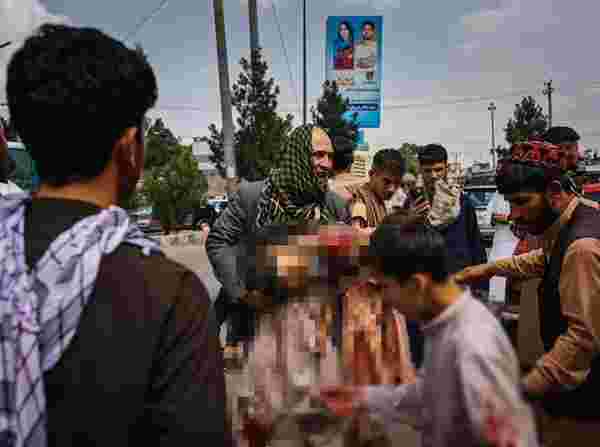 Bu görüntülere yürek dayanmaz! Taliban zulmü çocukları da kanlar içinde bıraktı