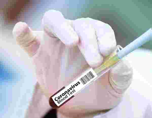 Çin, koronavirüse karşı 'yüzde 99 etkili olacak' aşı geliştirdi