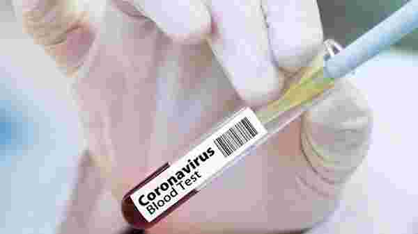Çin'den kritik corona aşısı açıklaması: Yüzde 99 etkili olacak