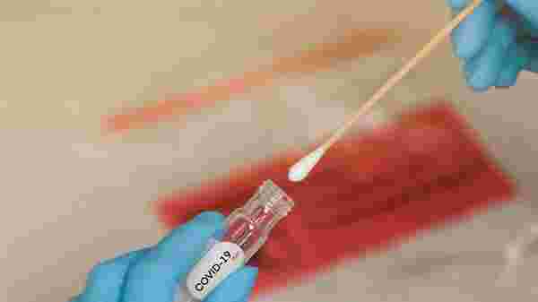 Corona virüsünde iyileşmiş kişilerin vücudunda antikorlar tespit edildi