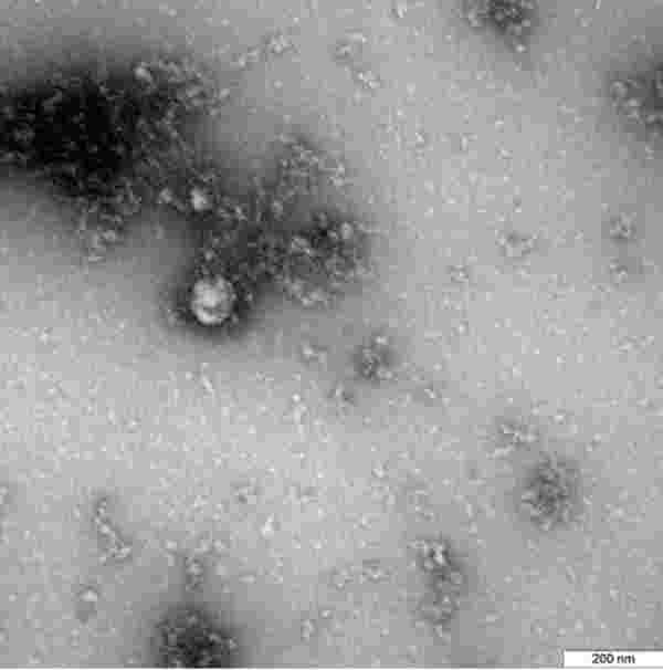 Rus bilim insanları koronavirüsün İngiltere'deki mutasyonunun fotoğrafını çekti