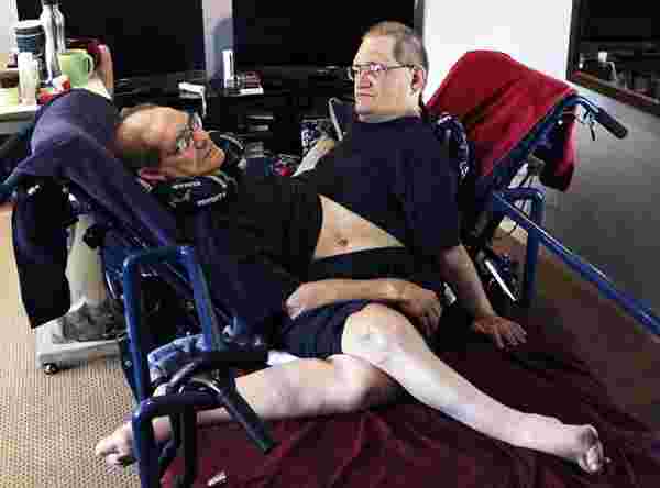 Dünyanın en yaşlı yapışık ikizleri hayatını kaybetti