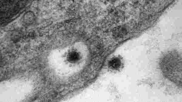 İşte milyonları hasta eden sinsi virüs! Korona Delta Plus'un en net hali görüntülendi