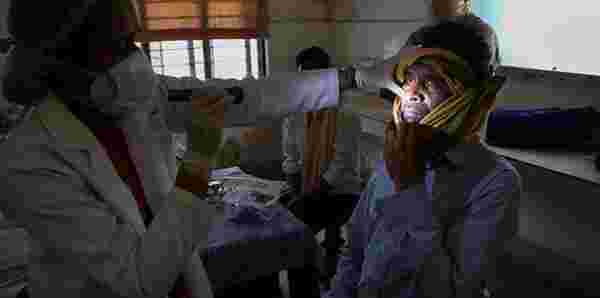 Koronanın pençesindeki Hindistan'da yeni hastalık! Doktorlar binlerce hastanın gözlerini oydu