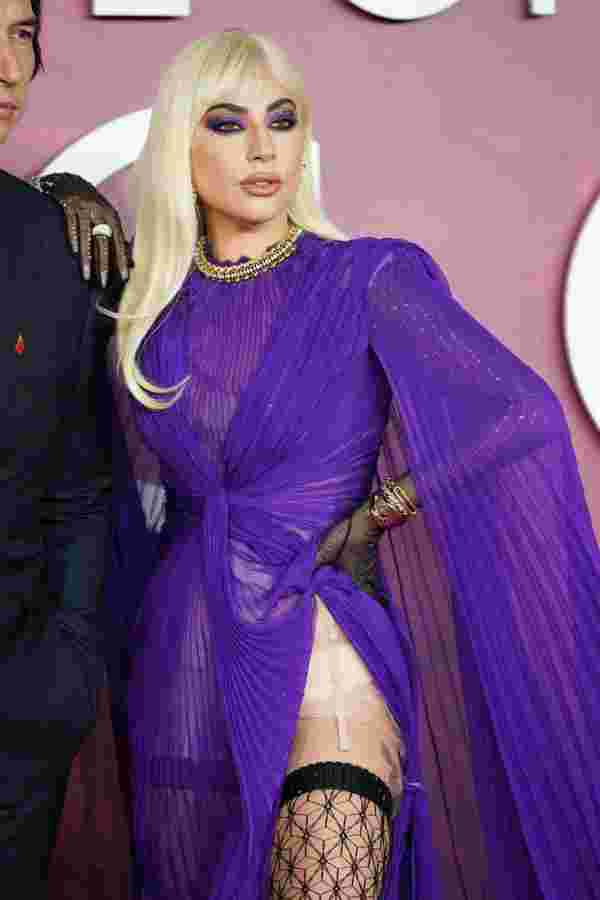 Lady Gaga, iç çamaşırını gösterdi #3