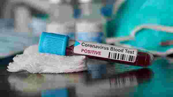Yeni koronavirüs enfeksiyonunu teşhis edebiliyor muyuz? Olası bir salgına hazır mıyız?