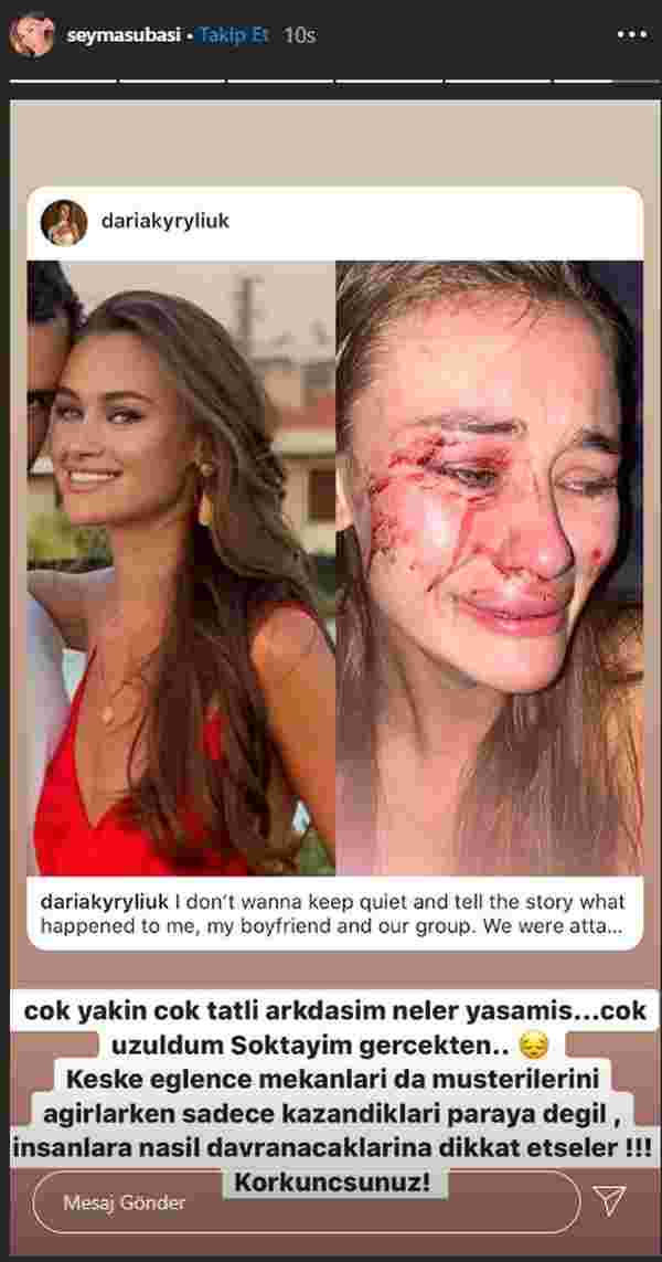 Top model Daria Kyryliuk Çeşme'de saldırıya uğradı #1