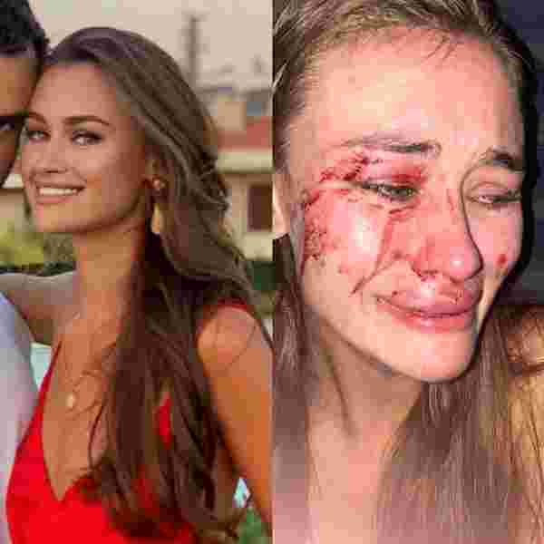 Ukraynalı model Daria Kyryliuk ve sevgilisi koronaya yakalandı #2