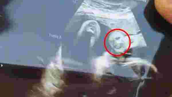 Ultrasonda bebeğinin yüzünde kaybettiği büyükbabasının yüzünü gören hamile kadın, şoke oldu