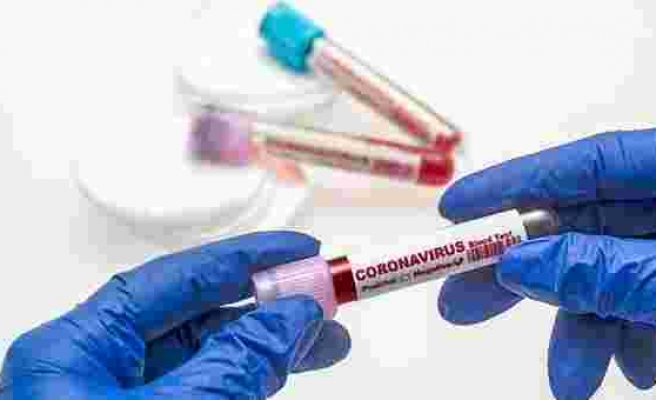 16 Ağustos Koronavirüs Tablosu Açıklandı: Yeni Vaka Sayısı 18 Bin 163