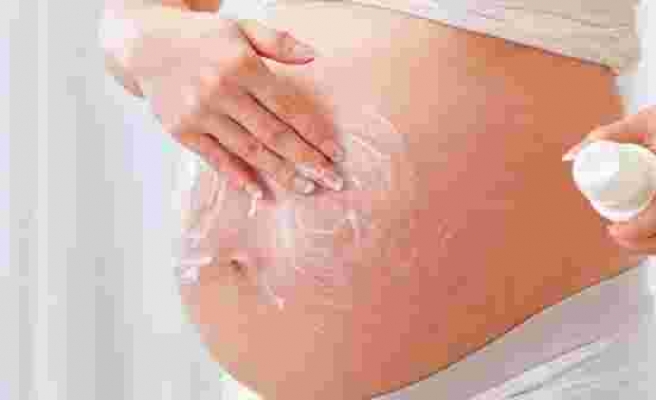 Hamilelikte çatlak oluşumu nasıl önlenir, çatlak oluşmaması için neler yapılabilir?