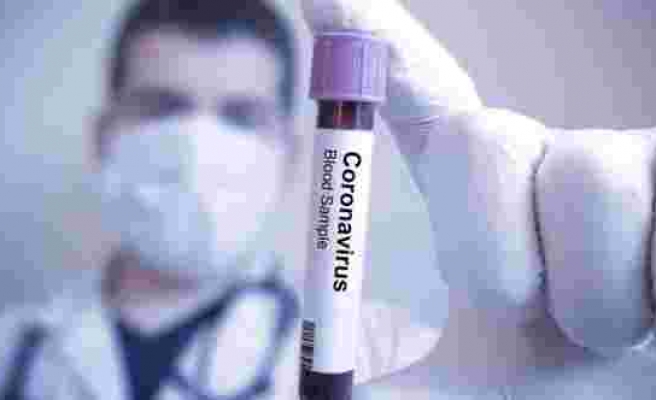 24 hastanın 23’ünde doğru tahmin! Corona hastaları için yeni kan testi geliştirildi