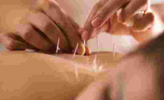 Akupunkturun hamile kadınlarda ağrıyı azalttığı bulundu
