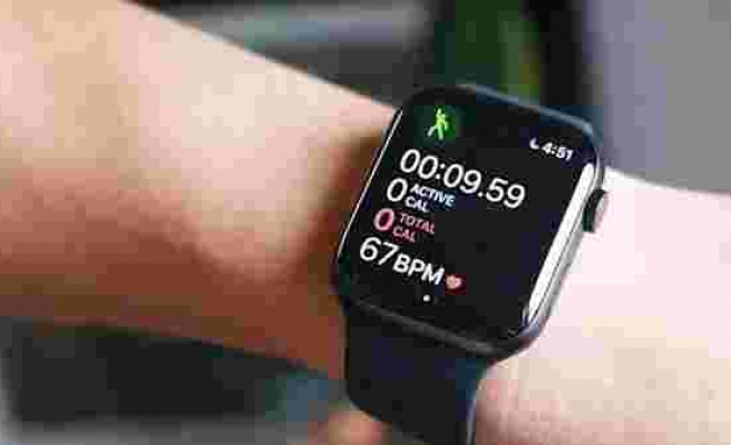 Apple'dan özel bir Apple Watch