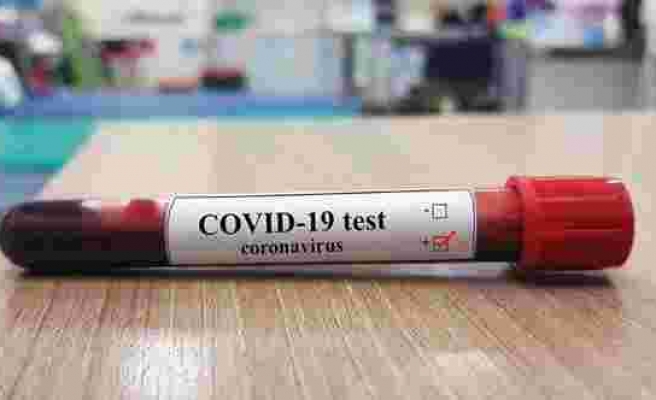 Balıkesir’de corona virüsü test sayısı 10 bini aştı