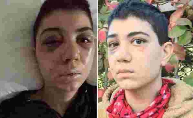 Beyoğlu'nda Kadına Felç Eden Dayak: Saldırgan Kayıp