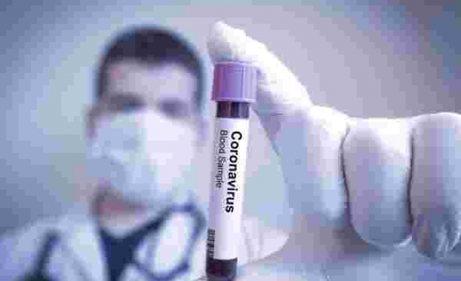 Bilim Kurulu Üyesi Ateş Kara'dan Korkutan Koronavirüs Açıklaması