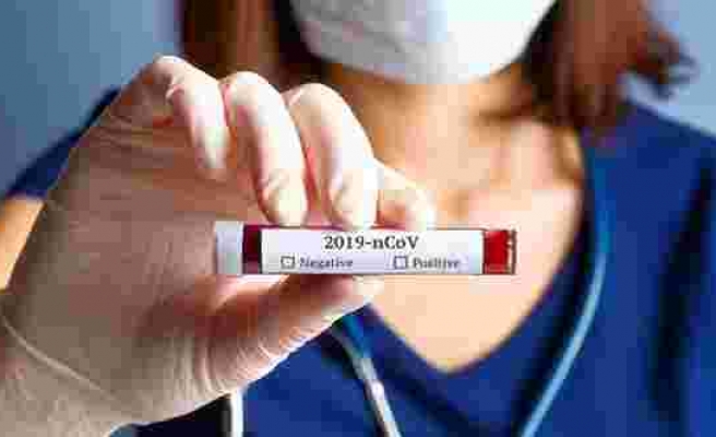 Bilim Kurulu üyesi Prof. Dr. Kara: HIV ve sıtma ilaçları virüsü zayıflatıyor