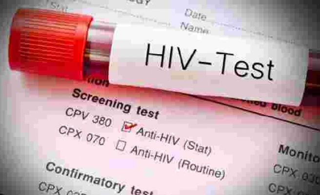 Bilim Kurulu Üyesi uyardı: Türkiye’de HIV pandemisi var!