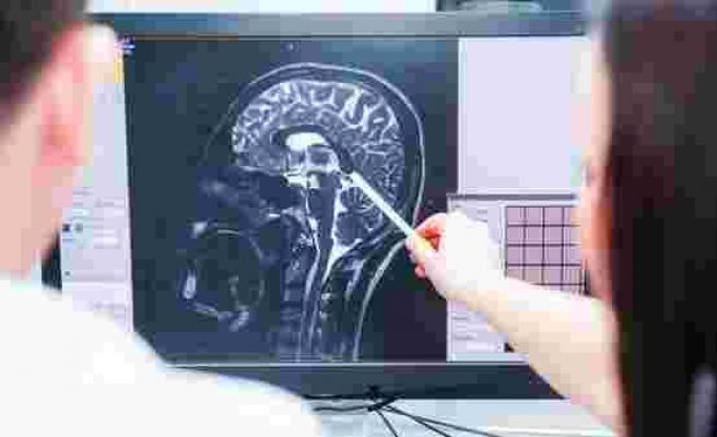 Bilimsel araştırma: Genç yaşta beyin sarsıntısı ileri yaşta demansa yol açabilir