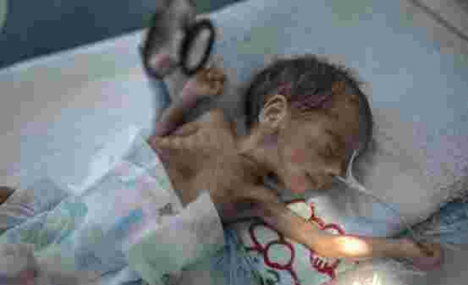 BM'den Yemen Raporu: Her 10 Dakikada Bir Çocuk Hayatını Kaybediyor