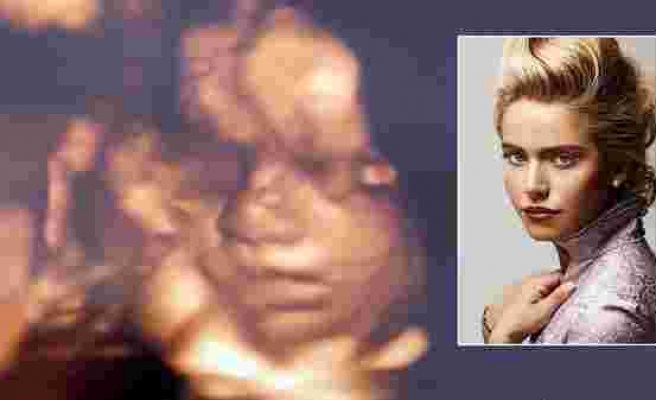 Ceyda Ateş bebeğinin ultrason görüntüsünü paylaştı