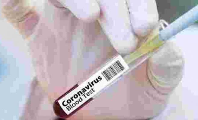 Çin’den kritik corona aşısı açıklaması: Yüzde 99 etkin olacak