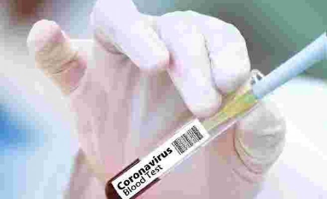 Çin, koronavirüse karşı 'yüzde 99 etkili olacak' aşı geliştirdi