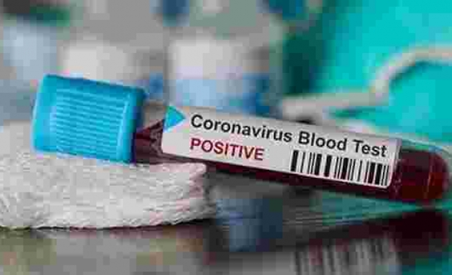 Corona virüsü aşısı gönüllü adaylar üzerinde uygulanıyor