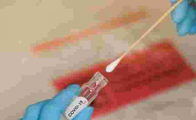 Corona virüsünde iyileşen hastalarda antikor tespit edildi