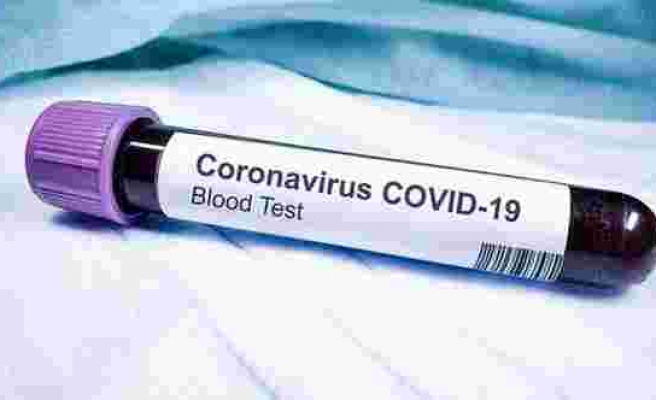 Corona virüsüyle ilgili ne dediyse hepsi doğru çıktı
