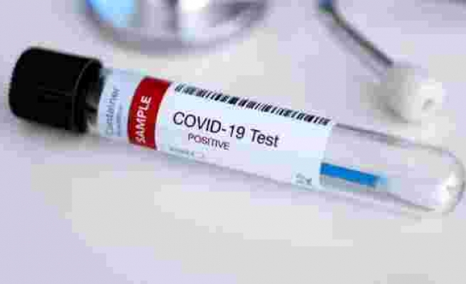 Covid-19’a ikinci kez yakalanmak mümkün mü? Antikorlar ve semptomlar…