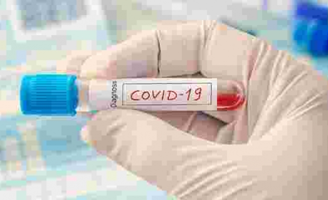 Covid-19 aşılarını binlerce Jumbo jet taşıyacak