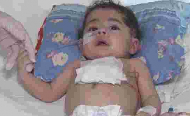 Dünyada 33, Türkiye’de 2’nci vaka: Bebeğin kalbine Türk doktordan ‘zırh’