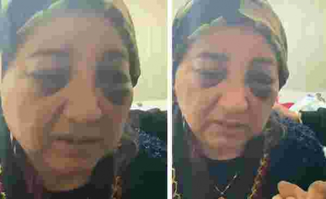 Eşini Gözleri Morarıncaya Kadar Dövüp Aç Bırakan Koca Tutuklandı
