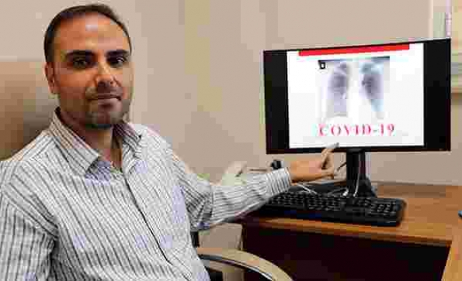 Geliştirdiği Yapay Zekayla Röntgen Filmlerinden Saniyeler İçinde Koronavirüs Teşhisi Yapıyor