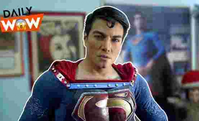 Hayatını Süperman'e Benzemeye Adayarak Defalarca Ameliyat Olan Adam: Herbert Chavez