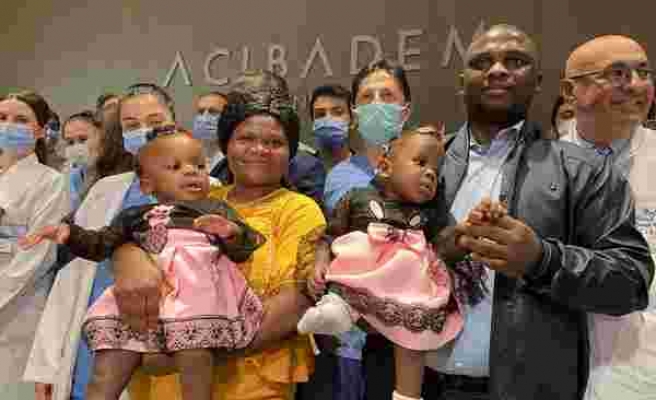 Kamerunlu yapışık ikizler Türkiye’de yeniden doğdu