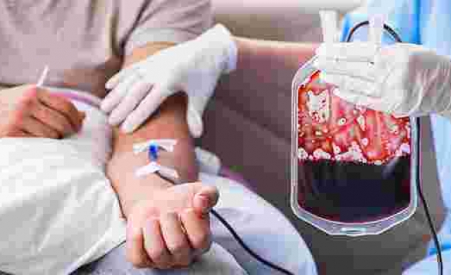 'Kan naklinin yan etkilerine karşı ‘hasta kan yönetimi' şart'
