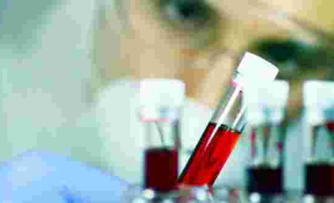 Kanser türlerini tespit edebilen kan testi umut vadediyor