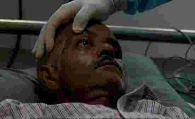 Kara mantar hastalarının tek gözünün çıkarıldığı ameliyatlardan yeni fotoğraflar paylaşıldı
