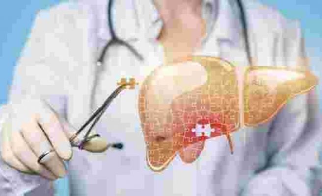 Karaciğer yağlanması nasıl önlenir?