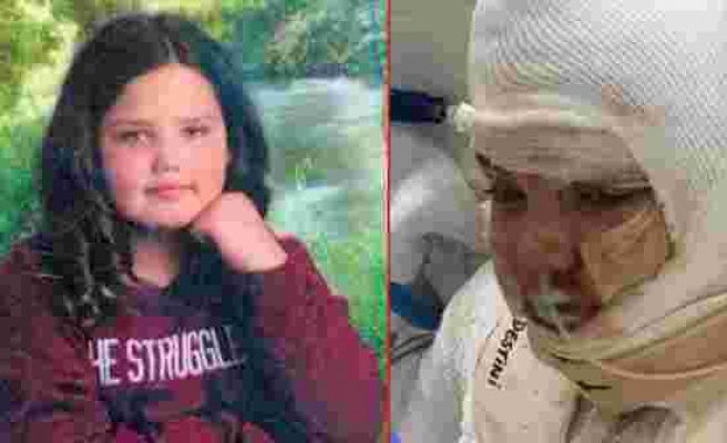 Korkunç olay! Tiktok'taki alkolle yazı yazma akımına katılan 13 yaşındaki kız çocuğu, alevler içerisinde kaldı