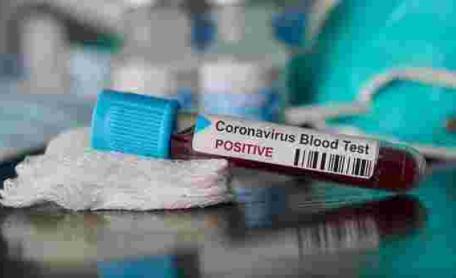 Koronavirüs testi yapma kriterleri genişletildi: Daha çok kişiye uygulanacak