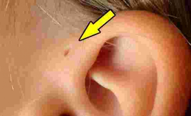 Kulaktaki küçük deliklerin sırrı ne