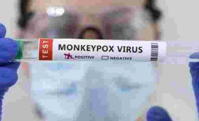 Maymun çiçeği virüsü İngiltere'de kontrol altına alınamıyor