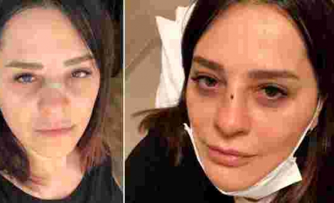 Meşhur şarkıcı Reyhan Karaca’nın burnu kırıldı!