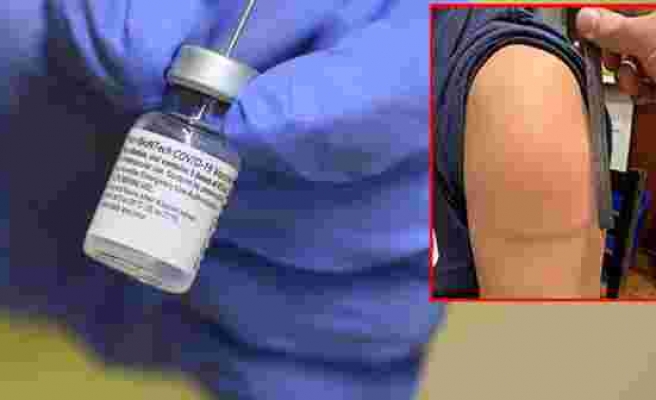 Moderna'nın koronavirüs aşısını yaptıran 14 kişinin kolunda 1 hafta içinde ağrılı kırmızı şişlikler oluştu