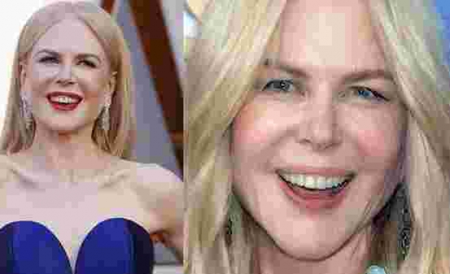 Nicole Kidman 1 haftada çöktü!